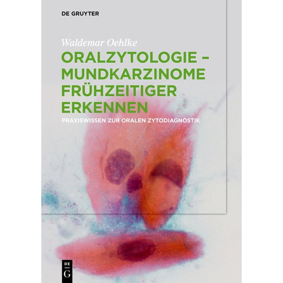 Oralzytologie - Mundkarzinome frühzeitiger erkennen, (Hardcover)
