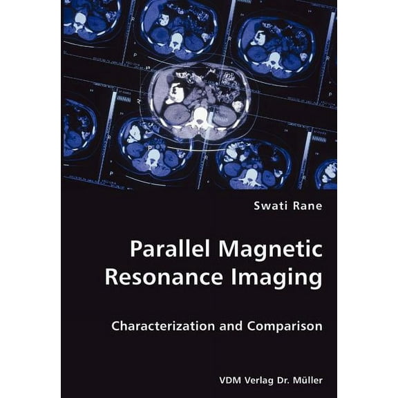 Parallel Magnetic Resonance Imaging (Paperback)