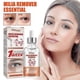 thumbnail image 5 of Speedy Milia Remover, Milia Remover Milia Spot Treatment, Speedy Milia Remover, Speedy Milia Remover, Helps Dissolve And Reduce Milia, 5 of 5
