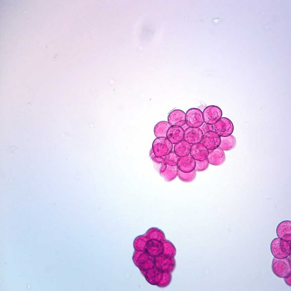 Dipylidium Caninum Eggs Slide, W.M.