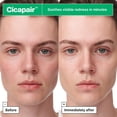 thumbnail image 3 of Sheet Mask Dr.Jart+ Cicapair Sérum para piel sensible, 25 ml, 3 of 5