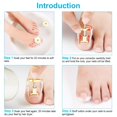 thumbnail image 5 of 2 Pieces Ingrown Toenail Lift Ingrown Toenail Tool Toe Clip Stainless Steel Foot, 5 of 5