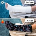 thumbnail image 7 of COEQINE Dragonfly Leg Cast Covers Size S Breathable Cast and Bandage Protector Easy to Clean Leg Cast Cover for Showering Machine Washable Foot Cast Cover After Surgery Gifts, 7 of 7