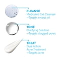 thumbnail image 3 of Sistema de tratamiento del acné La Roche-Posay Effaclar, 3 pasos, 2 meses, 3 of 7