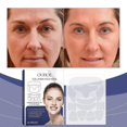 thumbnail image 1 of unique 16pcs Face & Forehead Wrinkle Patches, Anti Wrinkle Facial Patches to Reduce Fine Wrinkles, Frown, Smile, Neck & Chest Lines, Anti Wrinkle Trea, 1 of 5
