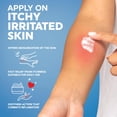 thumbnail image 5 of MED PRIDE 1% Hydrocortisone Cream 16oz Bulk Cortisone Anti Itch Cream for Eczema, Dermatitis, Rashes, Bug Bite Itch Relief & Skin Irritations, 5 of 8