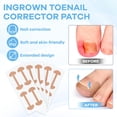 thumbnail image 3 of Kit de eliminación de uñas encarnadas con tiras para uñas encarnadas, parche corrector para uñas curvas, lima para uñas y herramientas para pedicura para mujer y hombre, 3 of 6