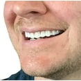 thumbnail image 3 of Natural Shade - Upper Veneer Cosmetic Teeth, 3 of 5