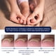 thumbnail image 2 of Líquido Reparador De Uñas Líquido reparador de uñas de 10 ml Líquido eficaz para uñas Multiusos para el cuidado de los pies, 2 of 8
