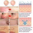 thumbnail image 3 of Crema reparadora de rojeces faciales, loción hidratante para mejorar la Rosacea Sooth, barrera de reparación de la piel sensible a la picazón, Cosméticos coreanos, nueva, 3 of 5