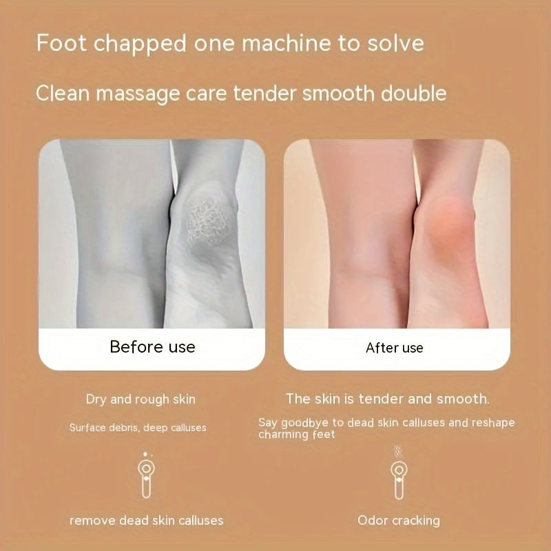Electric Callus Remover For Feet, Portable Pedicure Kit Foot File Callus Remover, Rechargeable Foot File For Foot Care Deadskin Remover With LCD Display