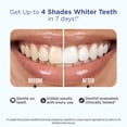 thumbnail image 2 of GuruNanda Teeth Whitening Strips - Non-Slip Dry Strip Technology - Clinically Tested , 30-Day Treatment, 2 of 12