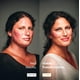 thumbnail image 3 of Sérum facial BIOSENS Vitamina C 10% con ácido ferúlico y vitamina E 30 ml, 3 of 9