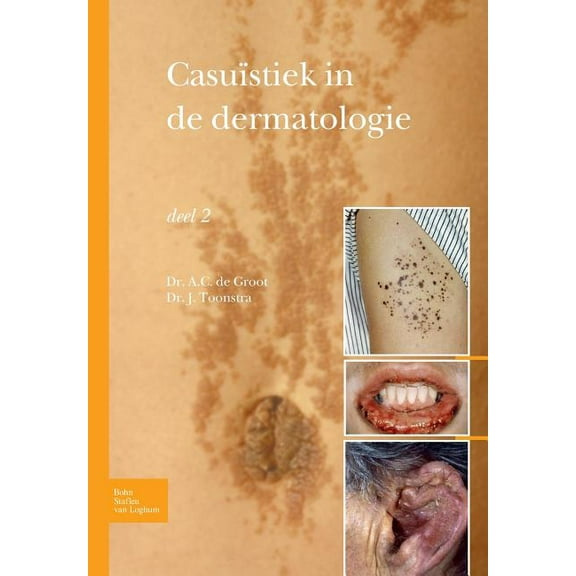 Casuïstiek in de Dermatologie - Deel 2, (Paperback)