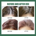 thumbnail image 3 of facefd 100ml 3.38oz Leave in Hair Spray Convenient Oil Control Shampoo, 3 of 9