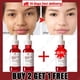 thumbnail image 1 of Suero facial reafirmante instantáneo para el cuidado de la piel, líquido antienvejecimiento para eliminar arrugas, Retinol, líneas finas, blanqueamiento, productos coreanos, 1 of 5