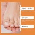 thumbnail image 3 of Bee Venom Nail Soothing Spray, Bee Venom Nail Fungus Soothing Spray, Toe Nail Treatments for Damaged Nails, Nail care, Safely and Gently, 20ml, 3 of 5