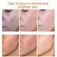thumbnail image 2 of Crema para blanquear las pecas Belita Amy, crema para eliminar el melasma y manchas oscuras, gel hidratante para el cuidado de la piel Afortunado Sencillez, 2 of 2