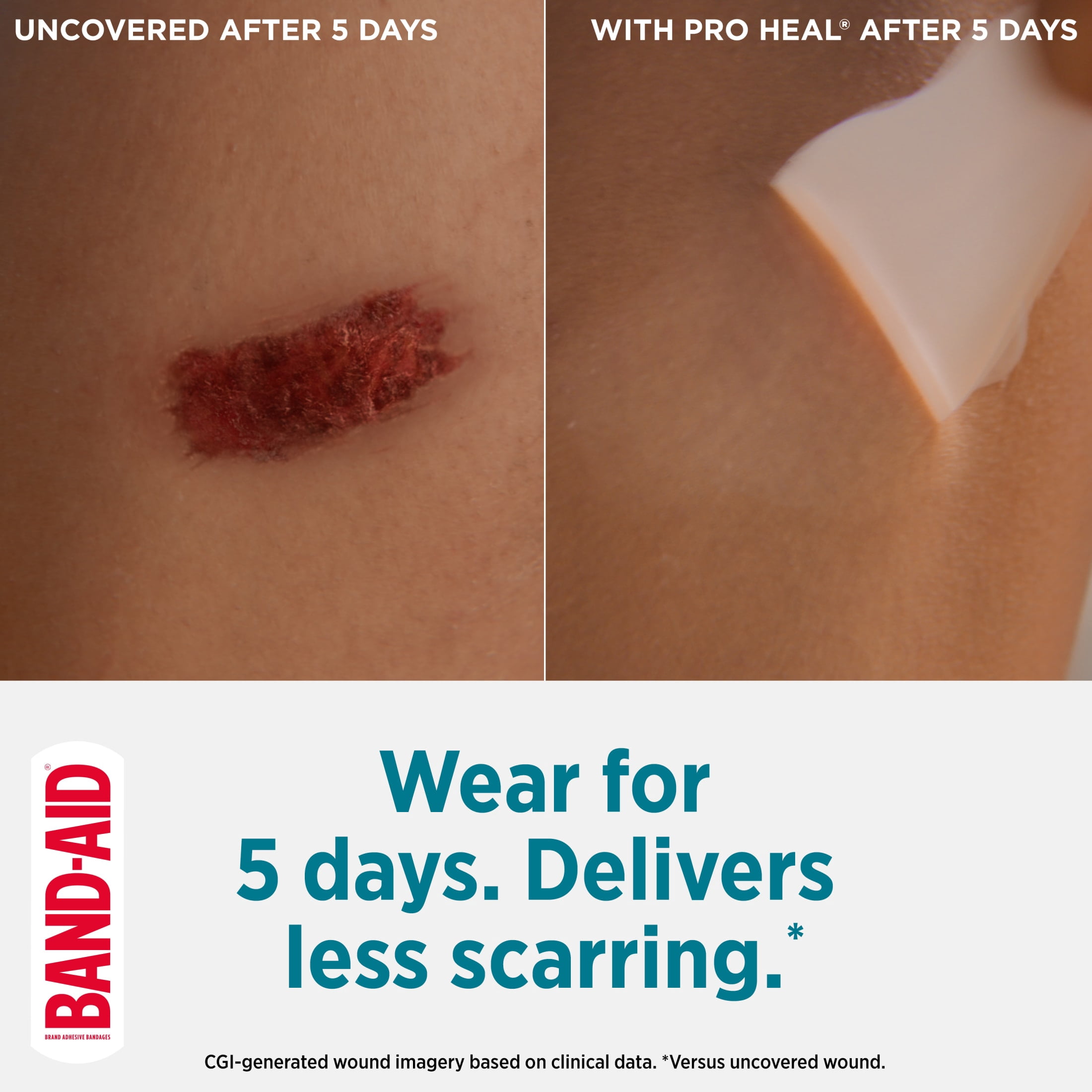 Band-Aid Brand Pro Heal 5 Day Protect Hydrocolloid Bandages, Waterproof, 10 Count