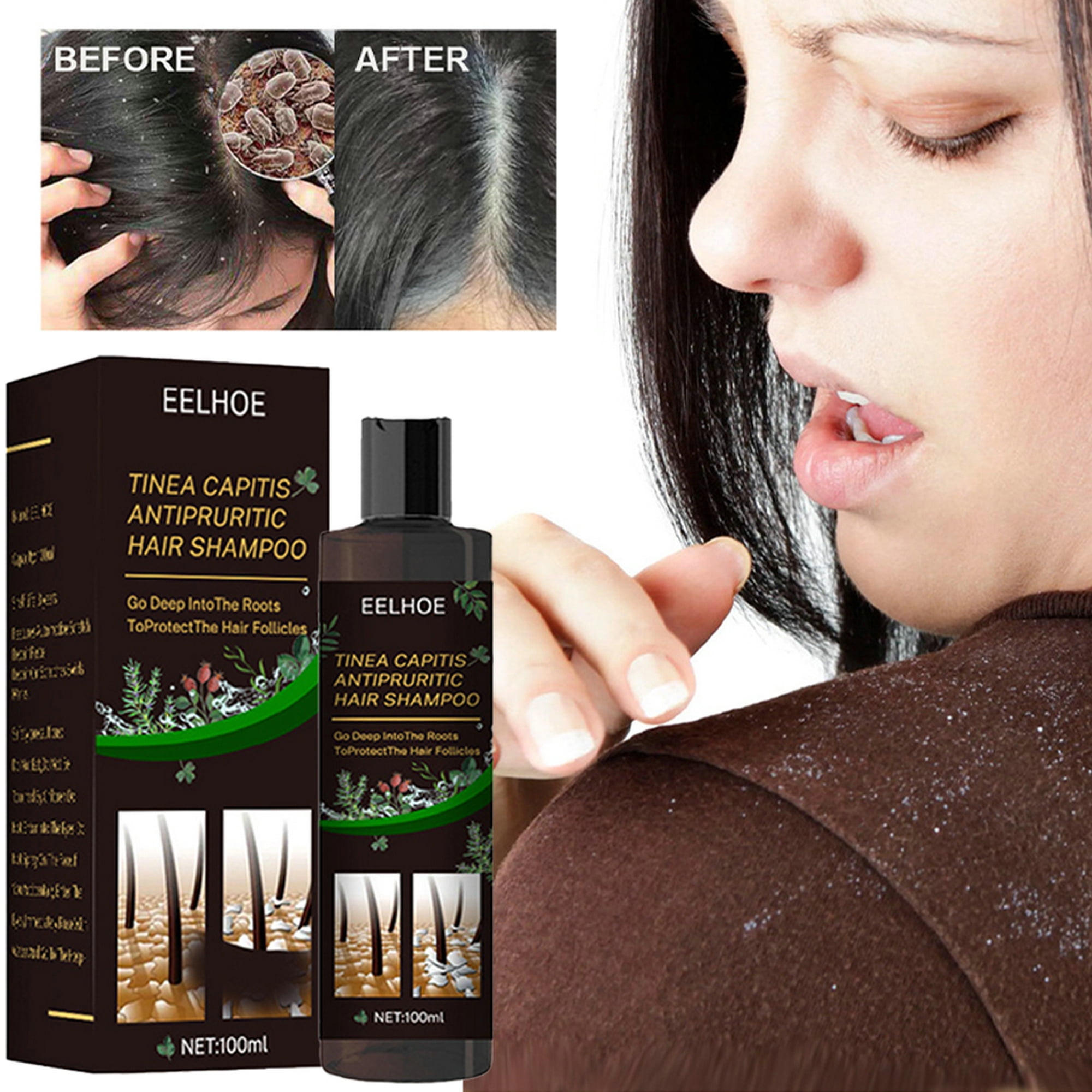 sværge Igangværende Kronisk Baloco Anti-Dandruff Shampoo Soothe Scalp Psoriasis Itching Flaky Scalp  Anti Hair Loss - Walmart.com