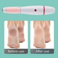 thumbnail image 3 of Electric Foot File Callus Remover Heels Grinding Pedicure Machine (Pink), 3 of 7