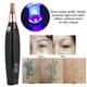 thumbnail image 3 of Pluma para eliminar manchas, Spot Eraser Pro Manchas Cara Eliminación Plasma Pen Facial Machine Tratamientos Para Manchas Piel con gafas, 9 tipos Frecuencia de trabajo(EU) (US) Protección de La Piel Octpeak NO, 3 of 7