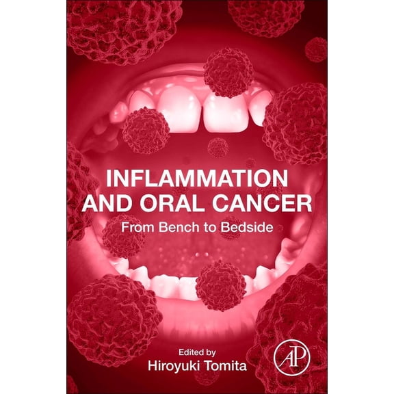 Inflammation and Oral Cancer: From Bench to Bedside, (Paperback)