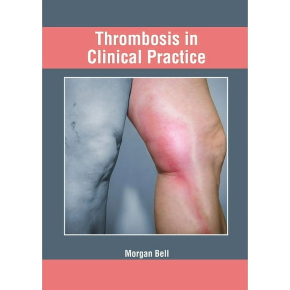 Thrombosis in Clinical Practice, (Hardcover)