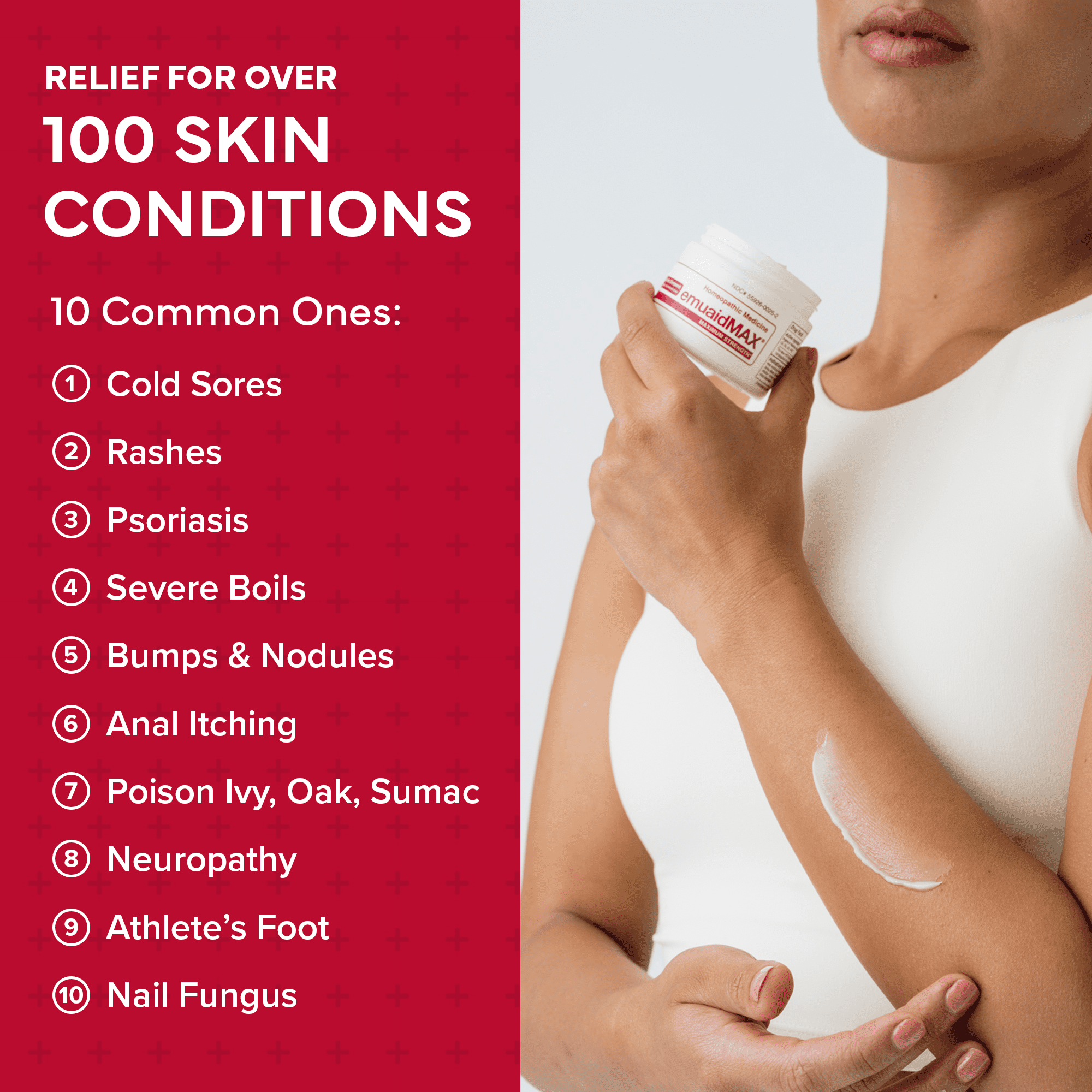 Emuaid EMUAIDMAX Ointment for Itchy Skin, Maximum Strength for Athlete’s Foot, Psoriasis, Jock Itch and Eczema, 2 oz
