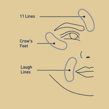 RoC Retinol Correxion Targeted Deep Facial Wrinkle Patches, 6 Ct