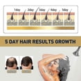 thumbnail image 5 of Jaysuing Ginger Conditioning Shampoo Refreshing Anti-dandruff Relieving Itc, 5 of 5