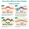 thumbnail image 6 of Dimora Silicone Scar Sheets, Extra Long Silicone Scar Tape, Waterproof Scar Treatment, Scar Removal Strips for Surgical Scars, C-Section, Keloid, Tummy Tuck, 1.6”x120" Roll, 6 of 7