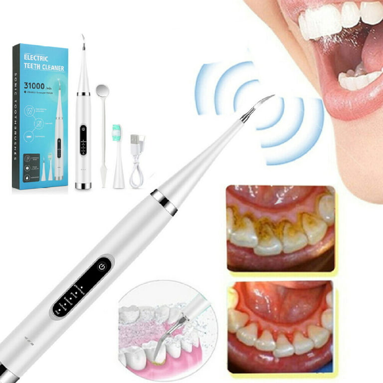 Ultrasonic Cleaning in Dentistry – Sonics Online