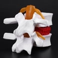 thumbnail image 4 of MasteelfCA 1pc Human Spine Model Lumbar Disc Herniation Presentation Model for School, 4 of 7