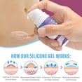 thumbnail image 4 of Silicone Scar Gel for New & Old Scars, Deeply Hydrates and Smooths Scar Tissue, Medical-Grade Ingredients for All Scar Types, 1 oz (2 pack), 4 of 10