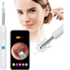 thumbnail image 1 of Otoscopio, Otoscopio de oído, cámara de oído 1080P, eliminación de cerumen Aibast, endoscopio de oído, 6 luces LED, adecuado para teléfonos inteligentes como iPhone, iPad y Android, 1 of 4