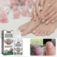 thumbnail image 3 of 3pcs EELHOE Anti Fungal Treatment Fungus Effective Finger Toe Nail Repair Liquid Solution -, 3 of 5