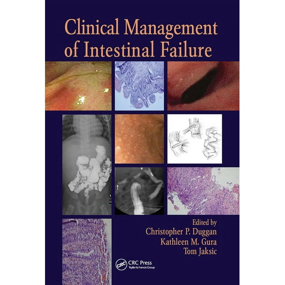 Clinical Management of Intestinal Failure, (Hardcover)