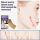 thumbnail image 5 of EELHOE 8Pcs Silicone Scar Sheets Safety Mild Odorless Comfortable Fade Scars Heal Treatment for Old New Scar, 5 of 5