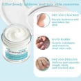 thumbnail image 6 of Foot Cream Nourishing Moisturizing And Softening Foot Care Cream, 6 of 8