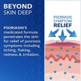Psoriasin Deep Moisturizing Ointment 2 Coal Tar Stops Psoriasis
