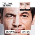 thumbnail image 4 of East Moon Men's Anti-Wrinkle Essence Anti-Wrinkle Firming Skin Young Elastic Moisturizing Transparent Essence -, 4 of 4