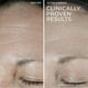 thumbnail image 5 of Crema facial hidratante RoC Hydration+ con ácido hialurónico 50 ml, 5 of 7