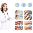 thumbnail image 3 of Micro Tags Auto Skin Tag Remover Kit Verruga Eliminación Pen Set Skin Tag Removal Pen Eliminador de verrugas sin dolor, 3 of 5