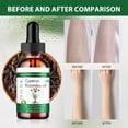 thumbnail image 3 of Aceite de Cyperus Rotundus Natural, 60ml, Aceite de Juncia para Reducción de Vello Corporal, Suavizante y Calmante (1PC), 3 of 7