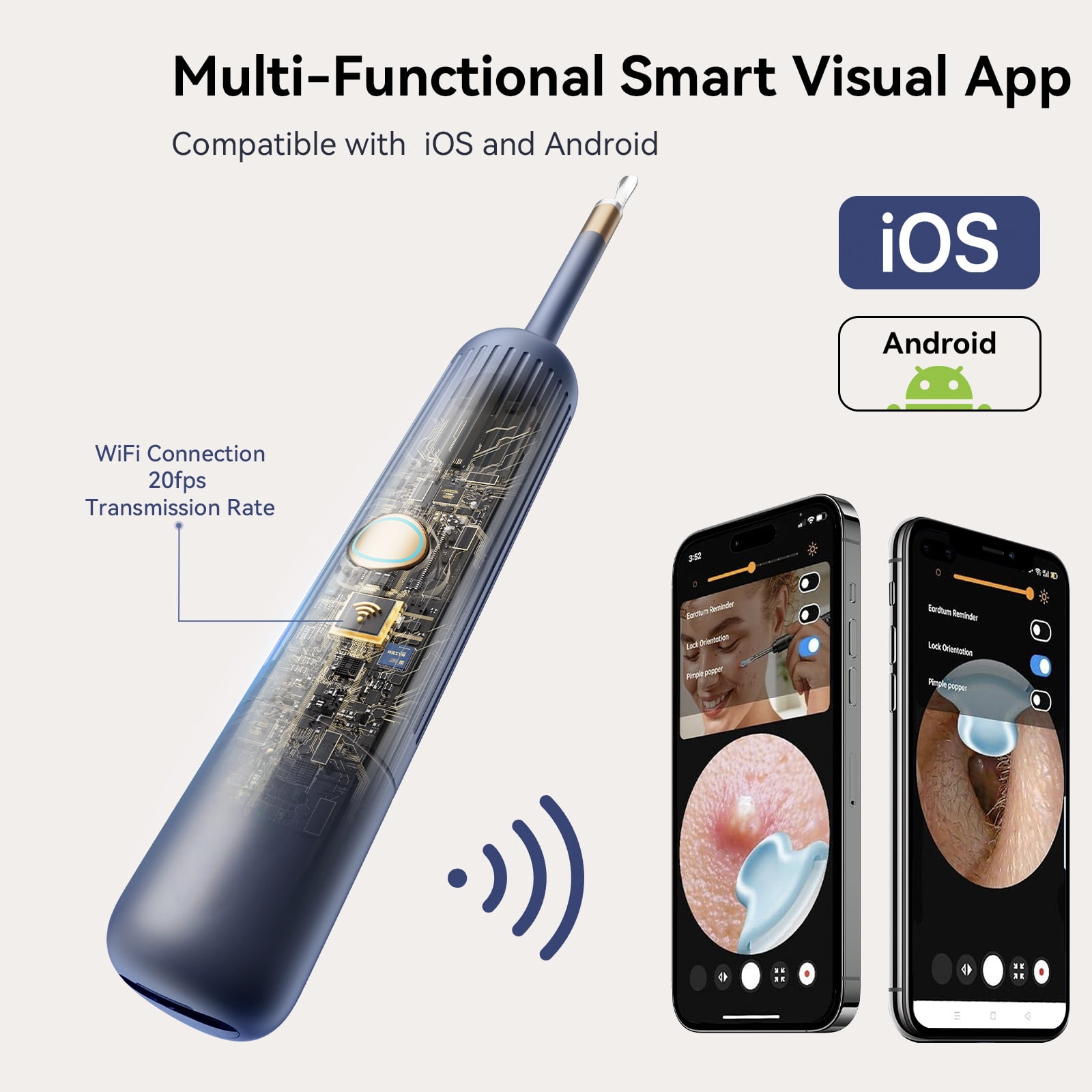 TCVOR Professional Ear Wax Removal Kit with Camera - 1080P HD Visual Ear Cleaner with Tweezers/Scooper/Scraper/Sponge/6 LED Lights Flexible Ear Otoscope - Portable Earwax Removal Tool for Home Use