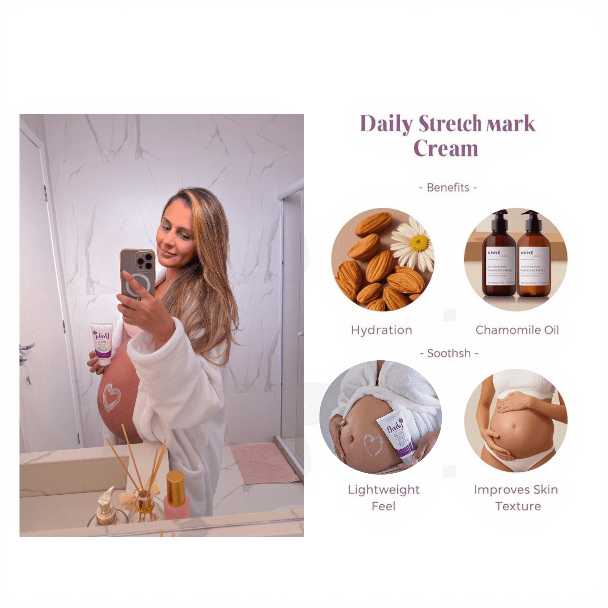 Michelle Marques Stretch Mark Cream – Pregnancy Safe, Hypoallergenic Formula with Almond Oil & Chamomile for Hydration and Elasticity (5.29 oz)