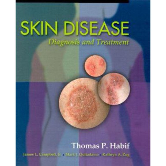Pre-Owned Skin Disease: Diagnosis and Treatment (Paperback) by Thomas P Habif, James L Campbell, Mark J Quitadamo