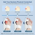 thumbnail image 3 of Bunion Corrector for Women & Men Big Toe, Adjustable Knob Bunion Splint for Pain Relief, Hallux Valgus Correction, White, 3 of 10