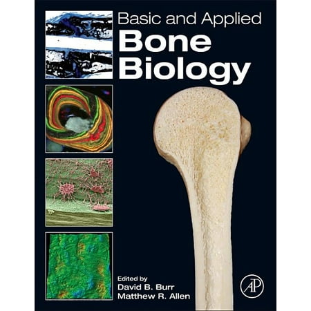UPC: 9780124160156 | Basic and Applied Bone Biology (Hardcover)